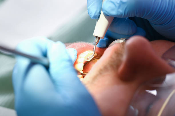 Best Emergency Dental Filling Replacement  in Ashland, OH
