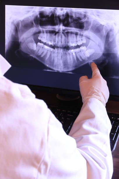 Best Knocked-Out Tooth Emergency  in Ashland, OH