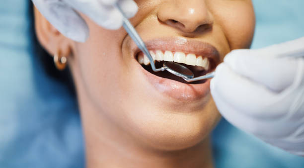 Best Dentist for Dental Trauma  in Ashland, OH
